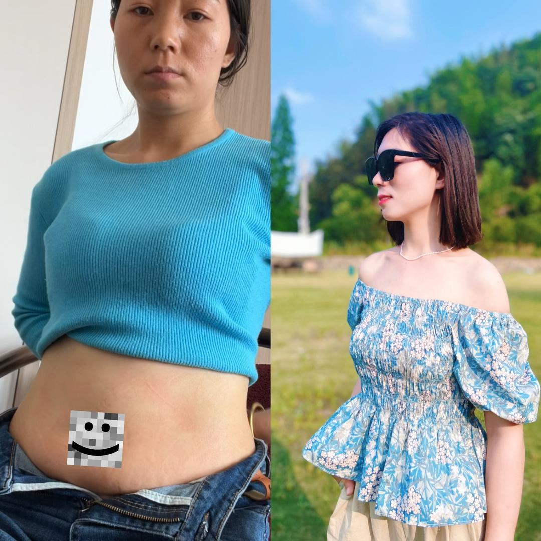 翠花瘦了   （已瘦37斤）