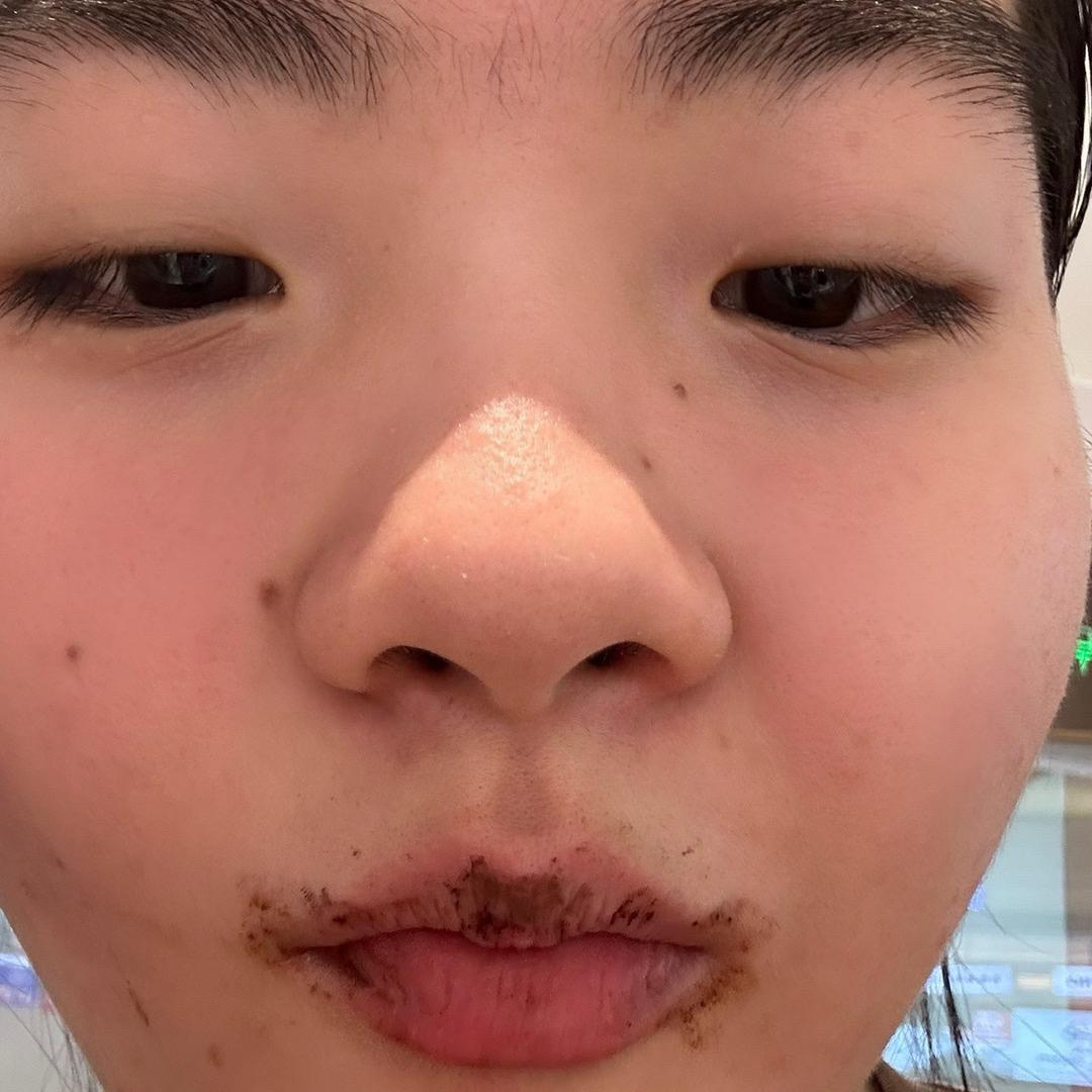 小脚趾