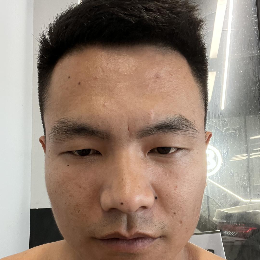 阿狗二手车