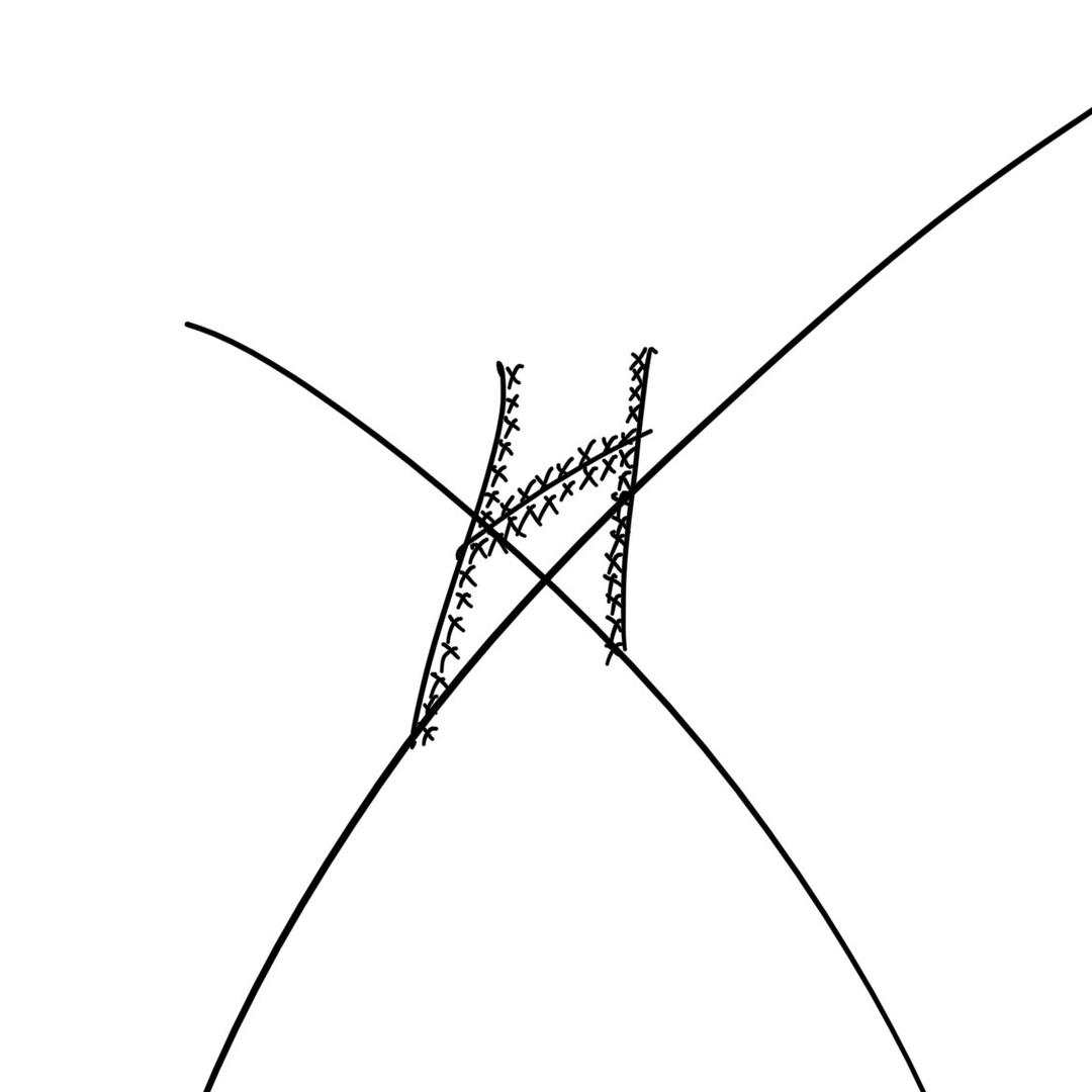 xH