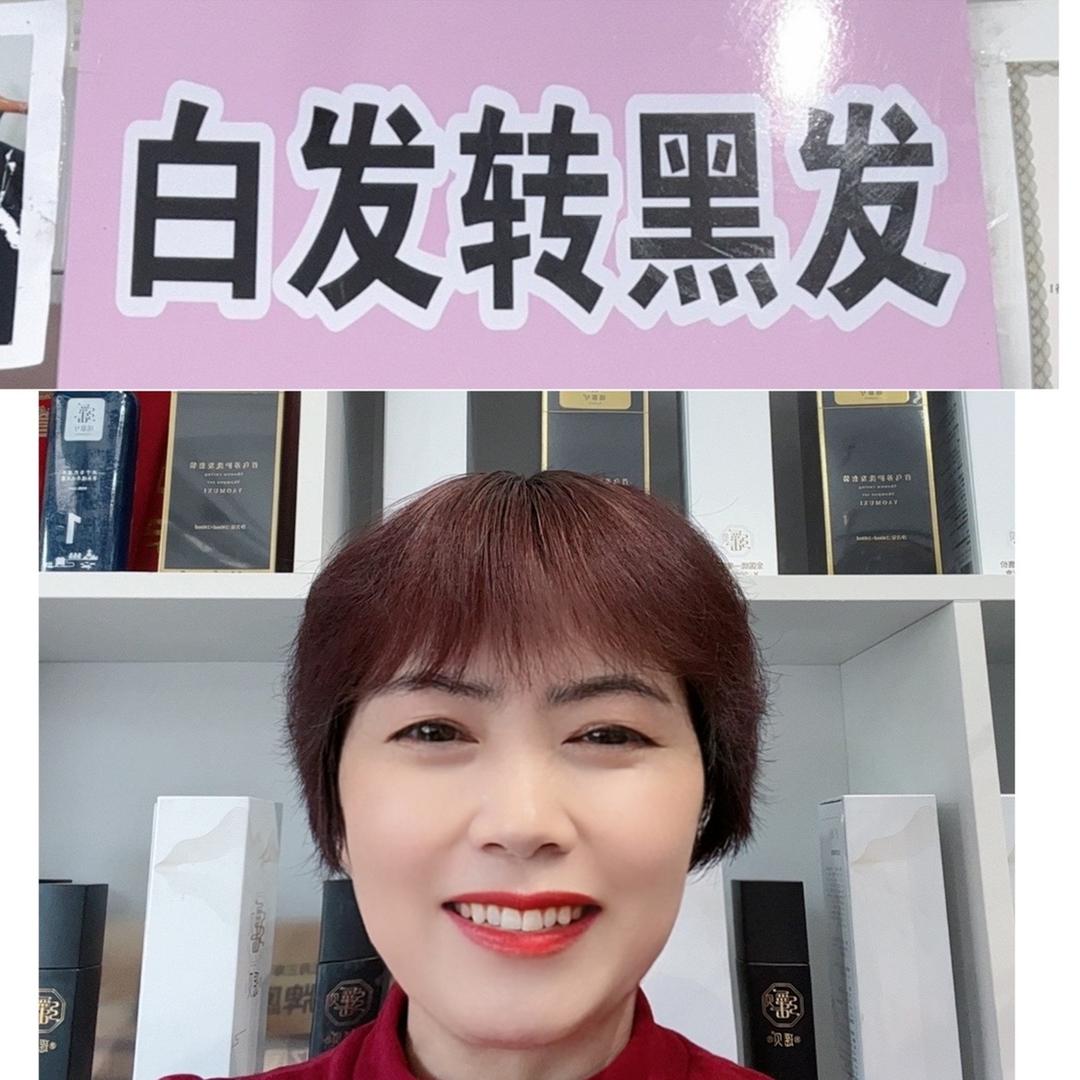 陈姐¥¥¥白发转黑发