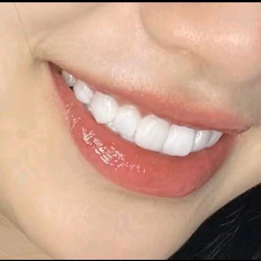 牙灵Yareling蓝玖口腔护理专卖店