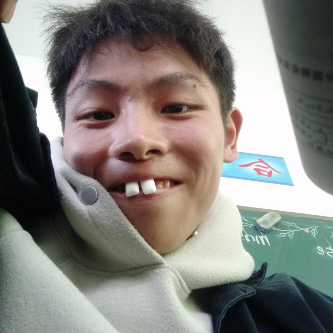 皮骨晏