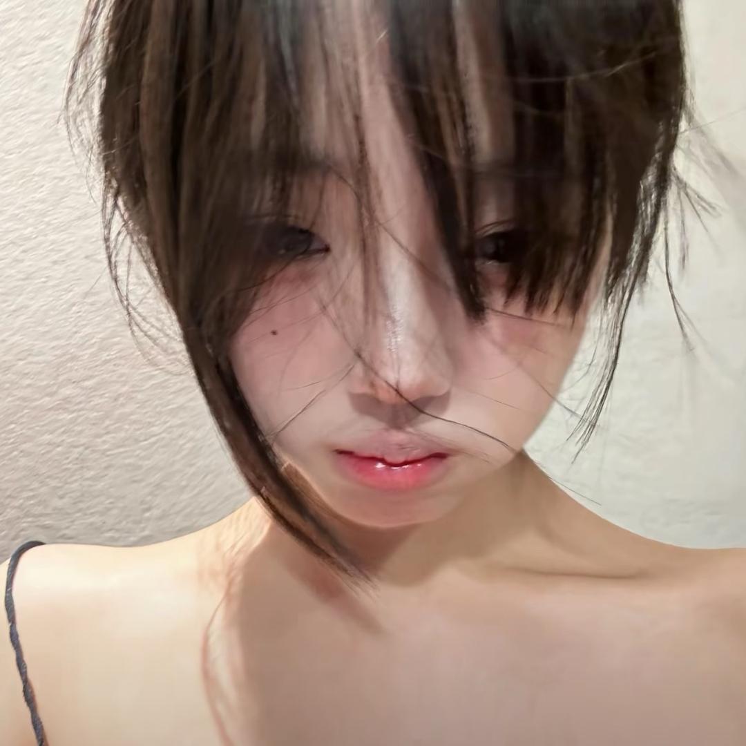 脸颊痣