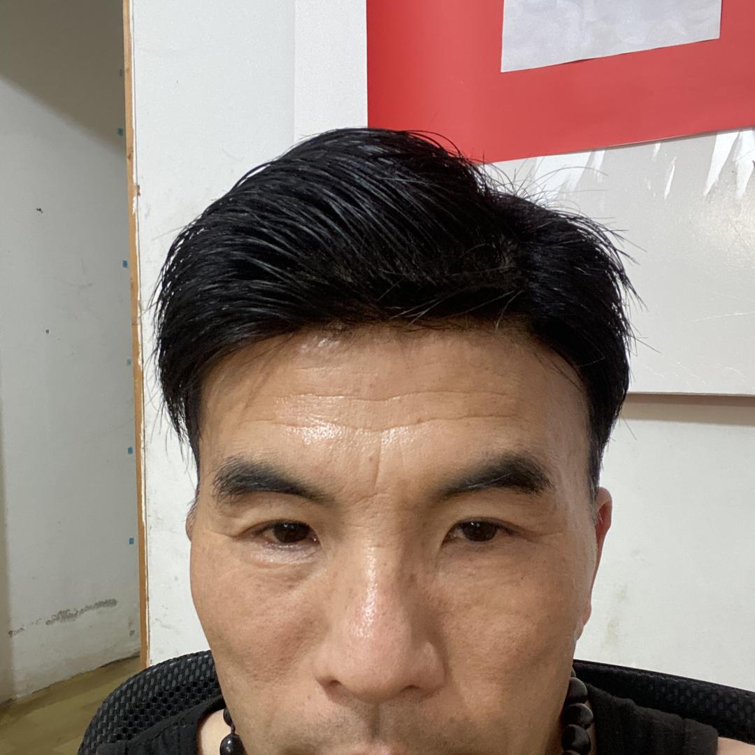 美兰析养发