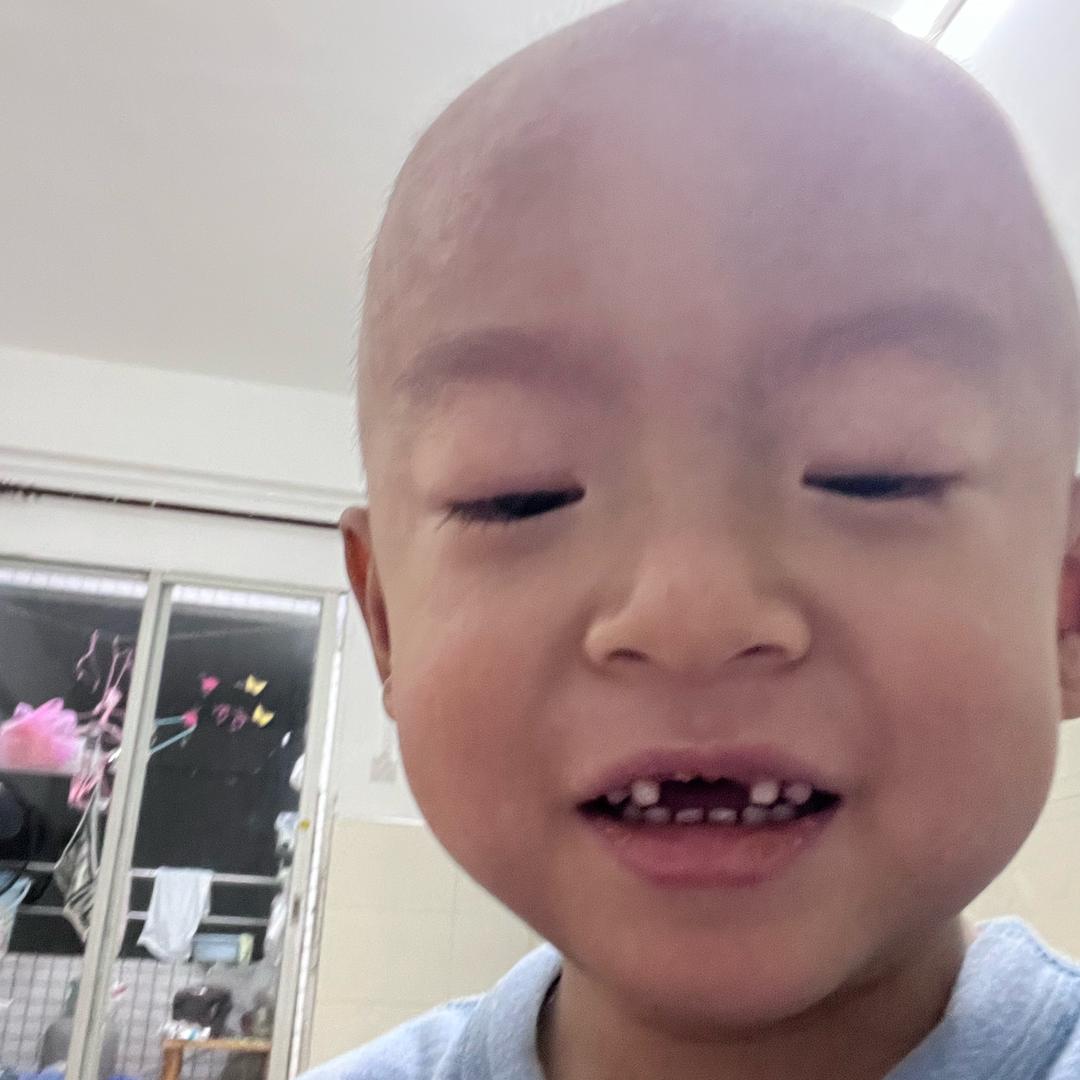 三个特殊孩子世界罕见病的母亲