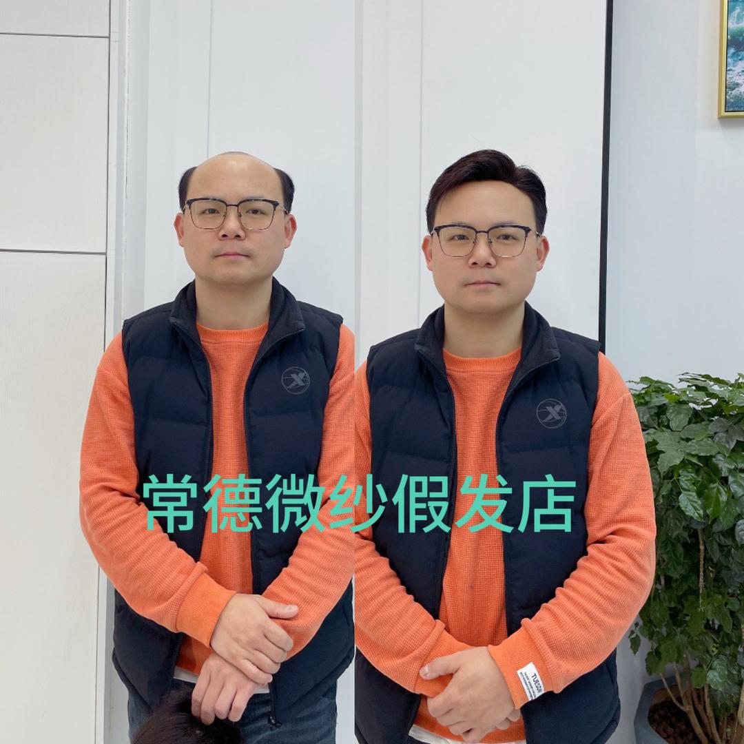 微纱假发店（生活号）