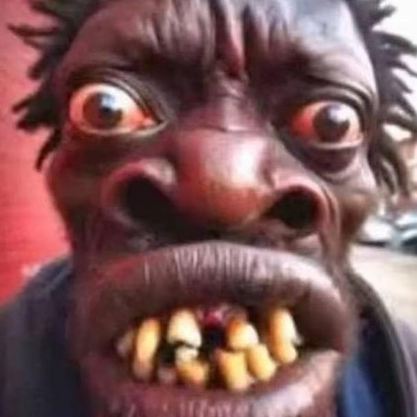 忧郁总裁兜不住屎被护工吊打