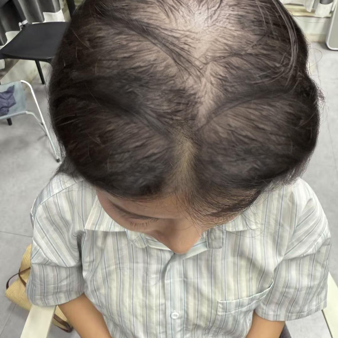 华渼芭西洗护发养发狂人