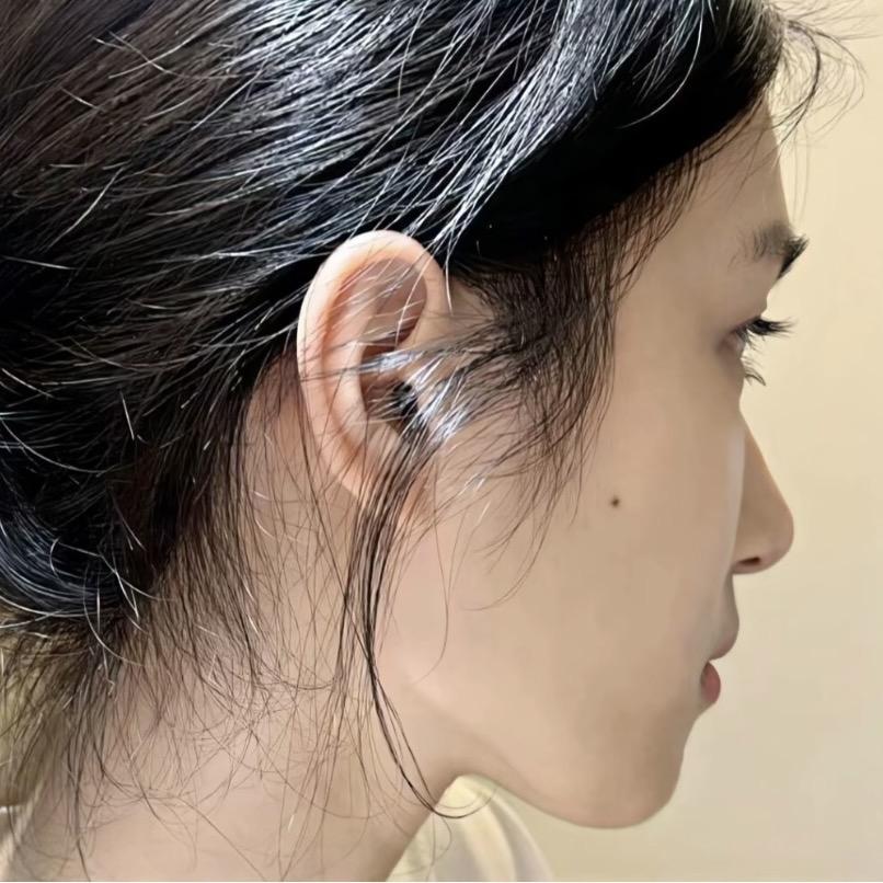 小龙虾