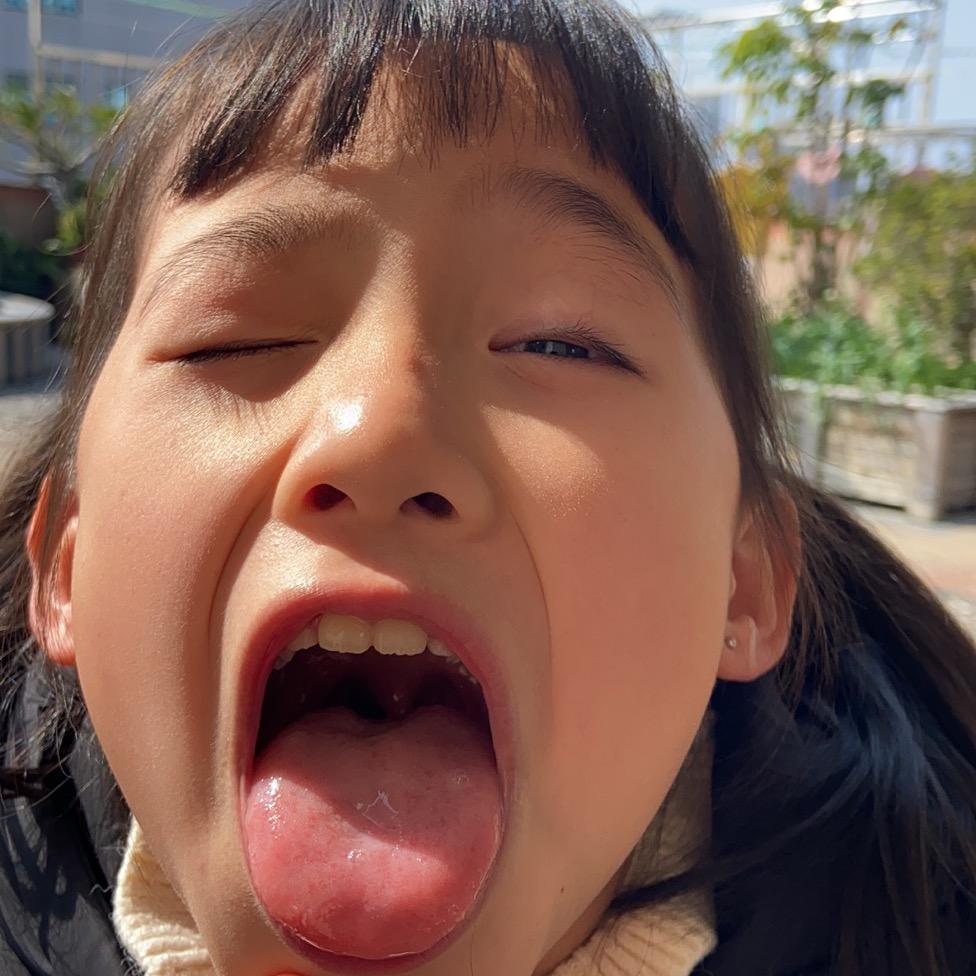 卷毛