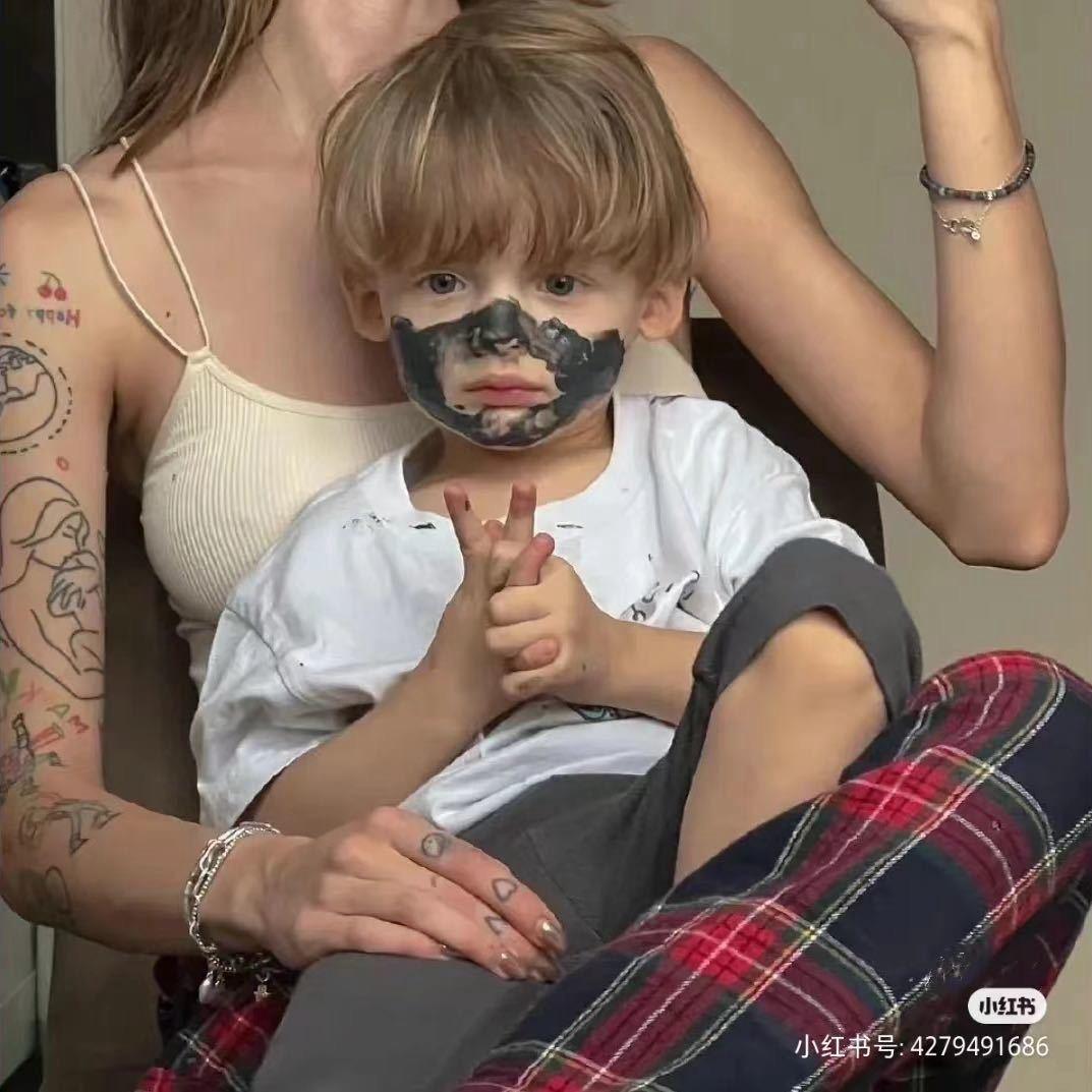 X .