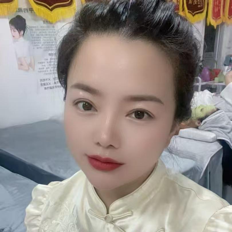 专业祛斑（莹莹）