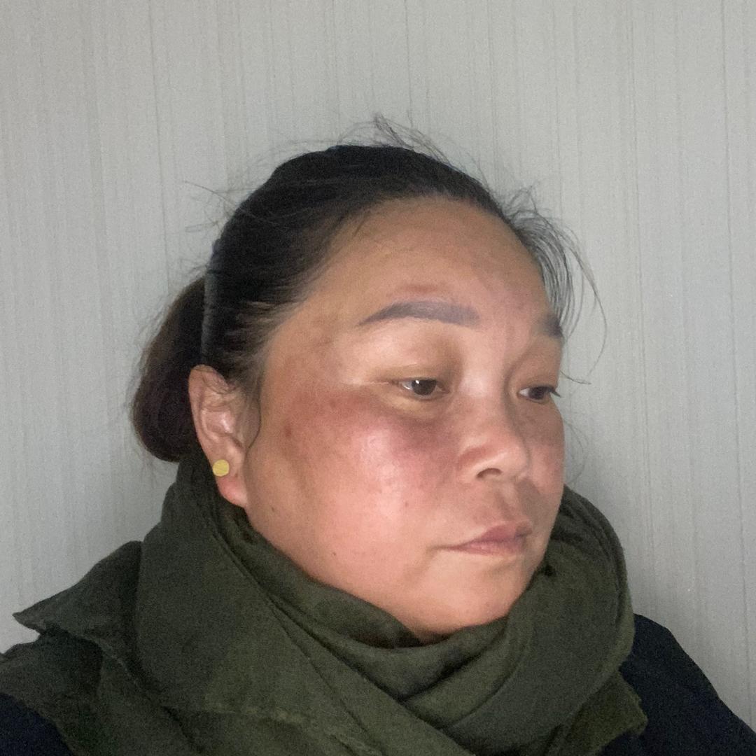 格秀美肤