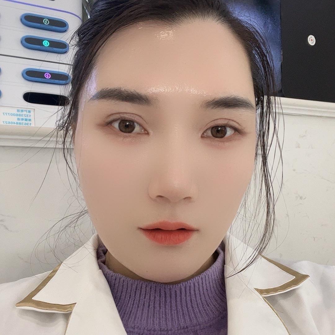 璐璐—班敏痘源头工厂