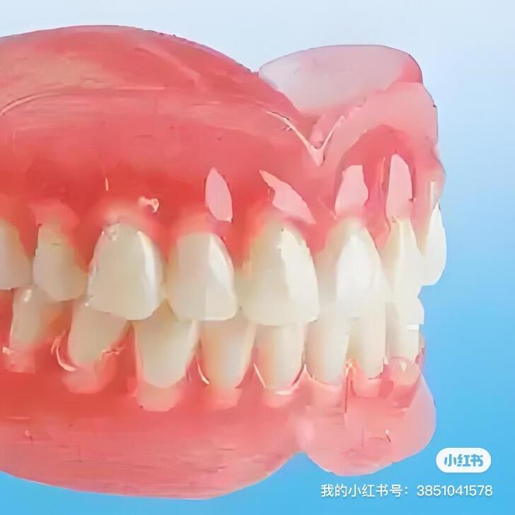 永久软衬全口义齿