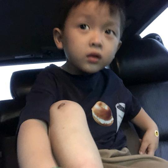 阿呆