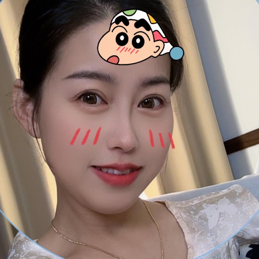 李晓琳