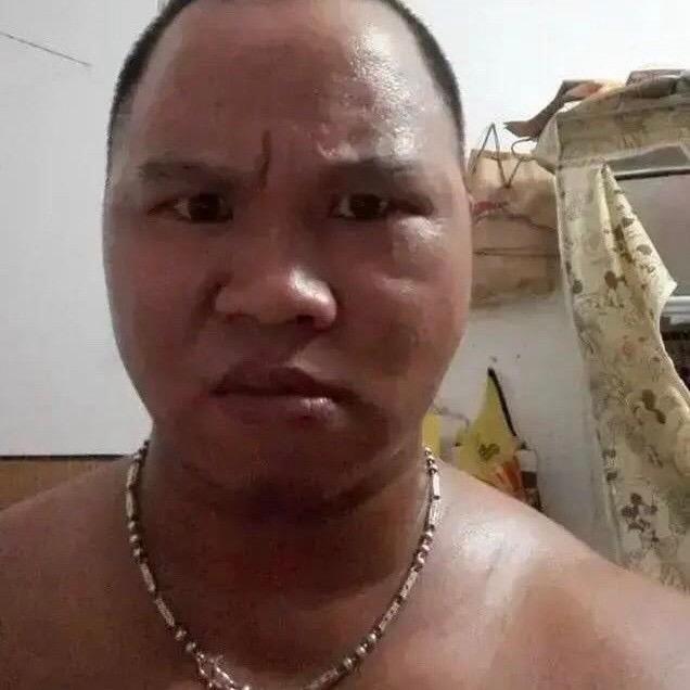 重生之我变成痔疮