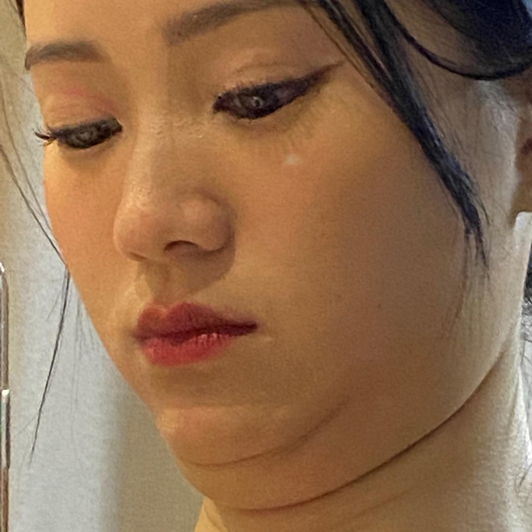 东曦