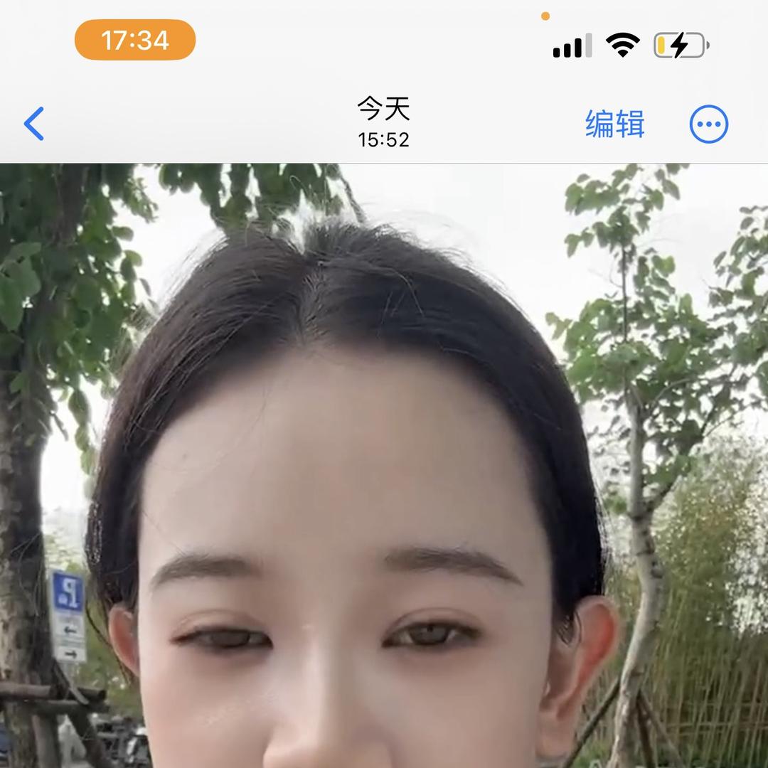 41632370420