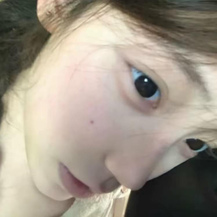 小美