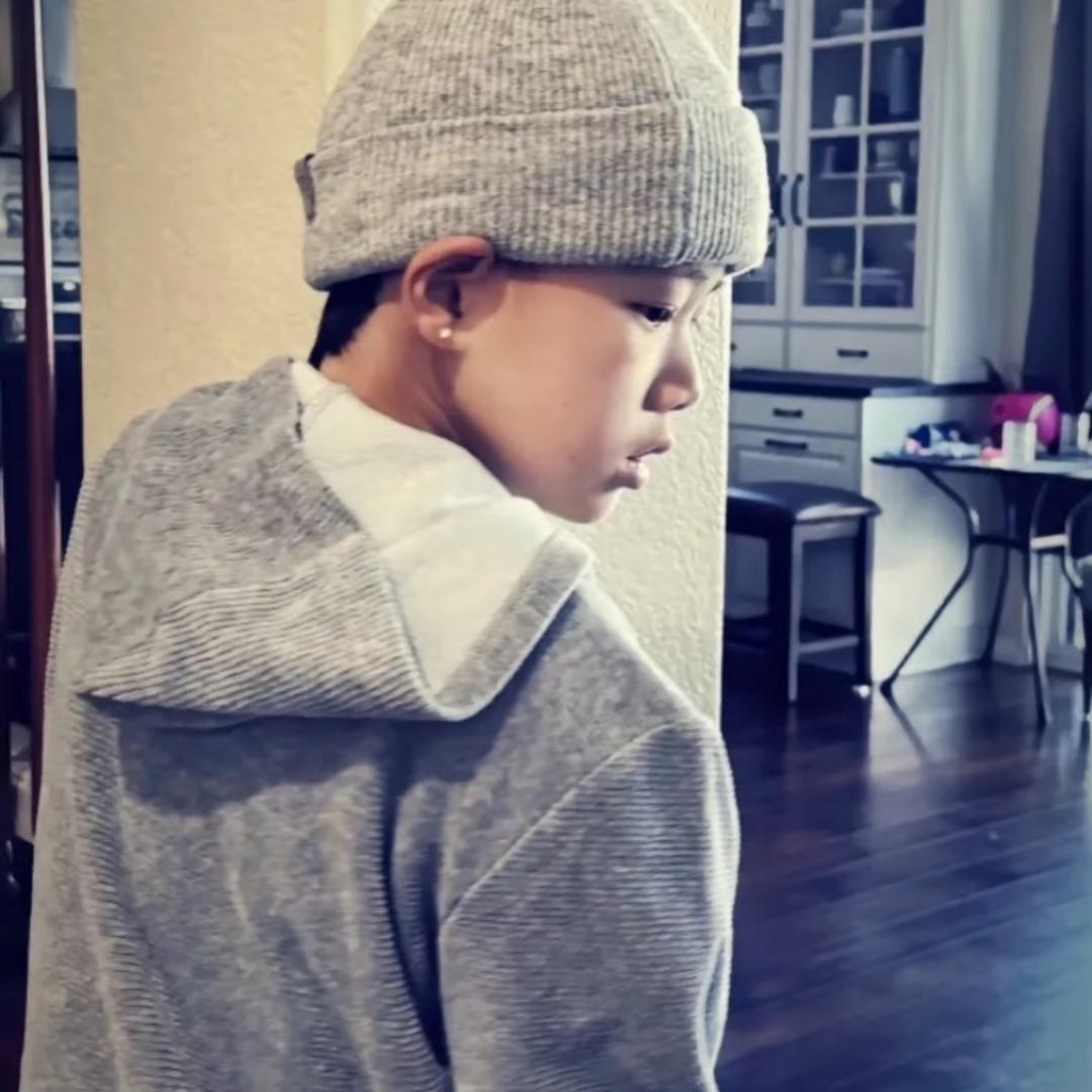 你的头发又又又炸了