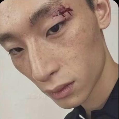 金