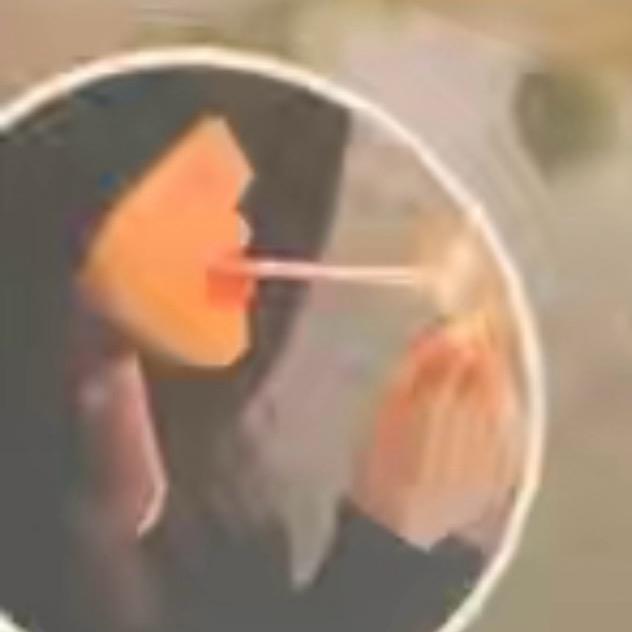玲