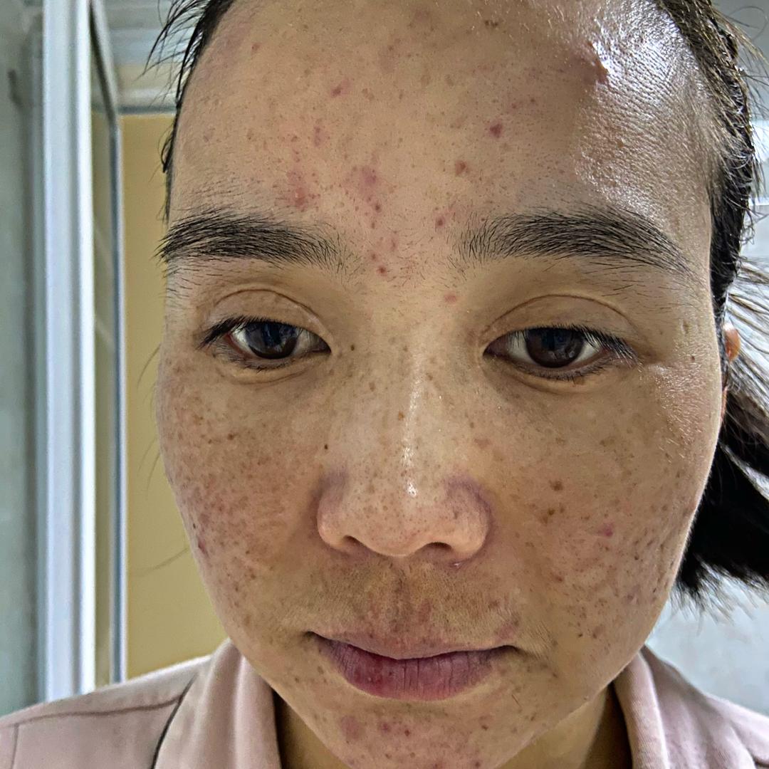 @吖冉你的护肤老师