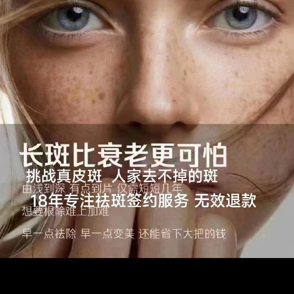 南宁念姐专祛斑痣