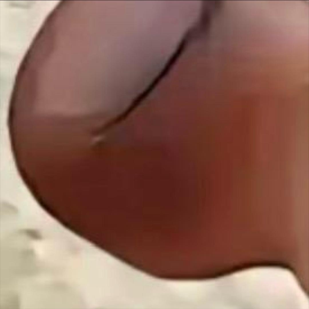 一身正气结果被扎漏气