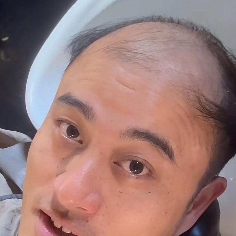 没毛造谣机（地中海肉喇叭）