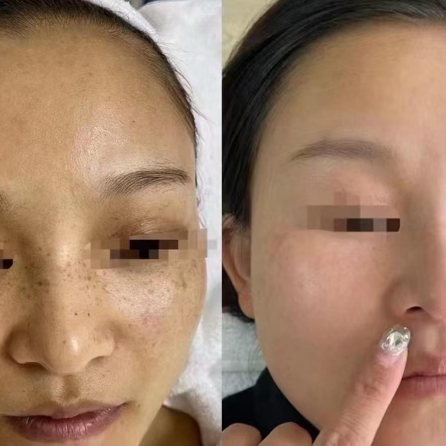 洛阳燕子问题肌