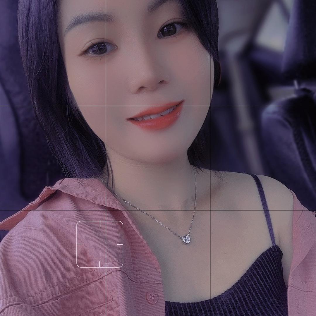 揭阳仙桥 阳光💫皮肤管理