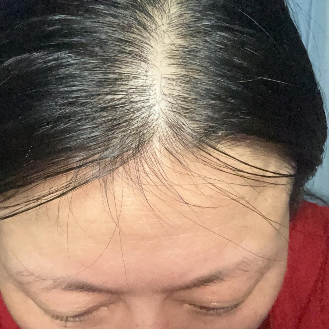 红英养发