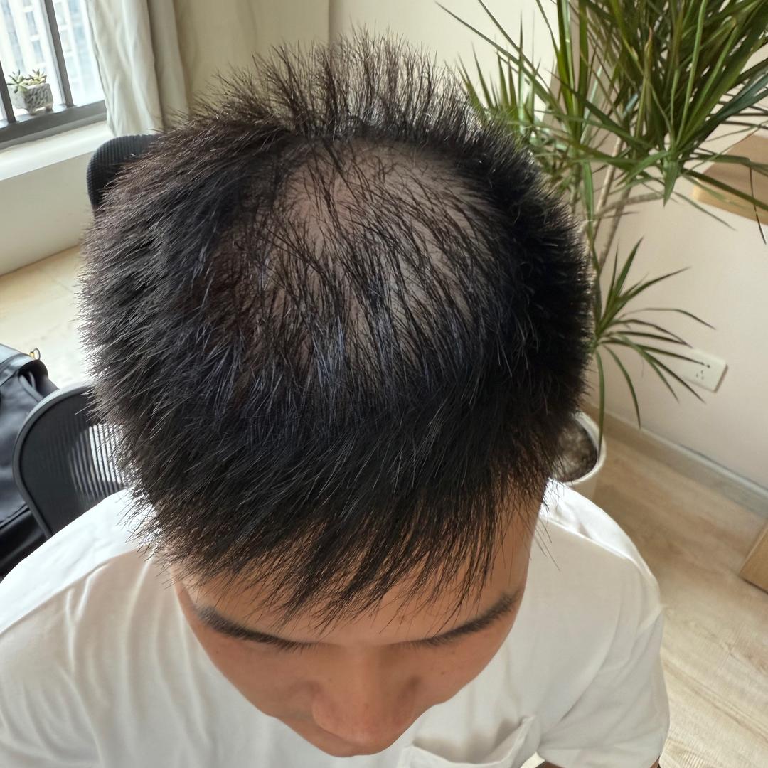 遇见秃头小周