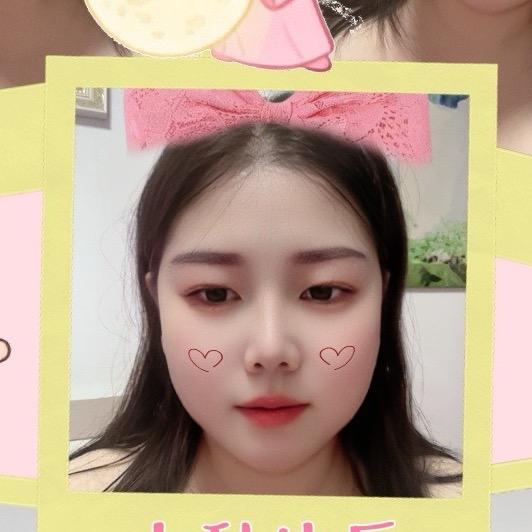 双面胶带郭建飞