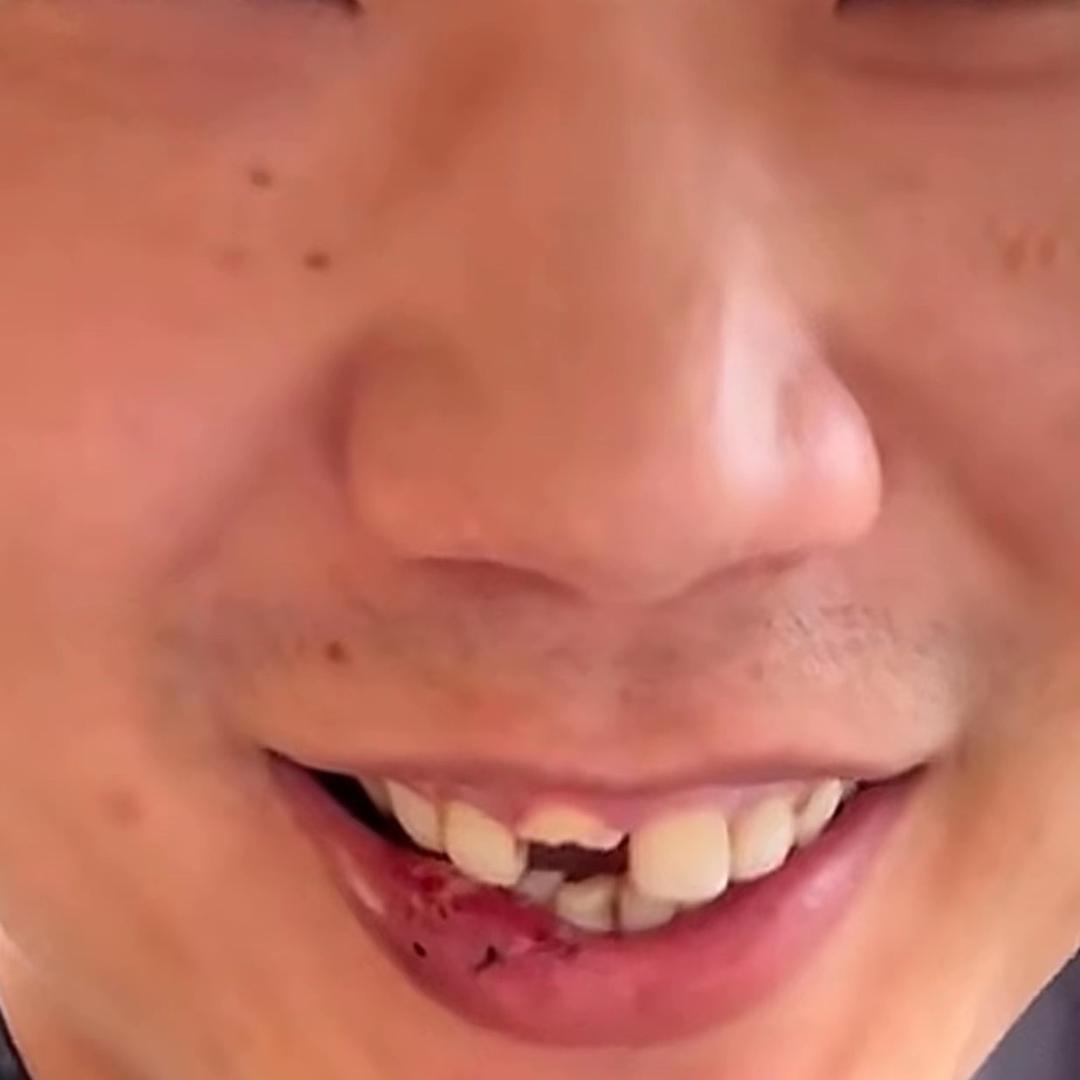 狂踹瘸子那条好🦵