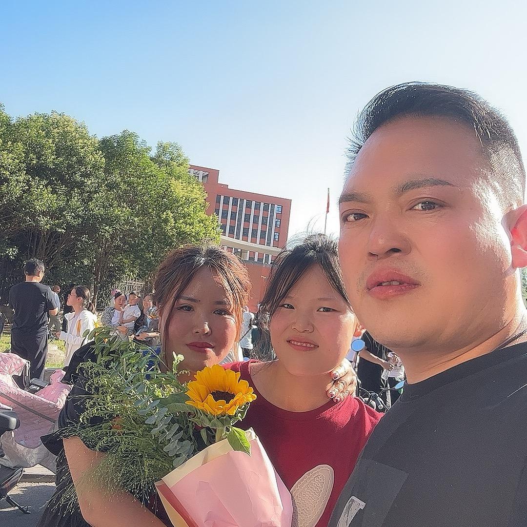 君丽痣斑疣痘纹绣洗文身