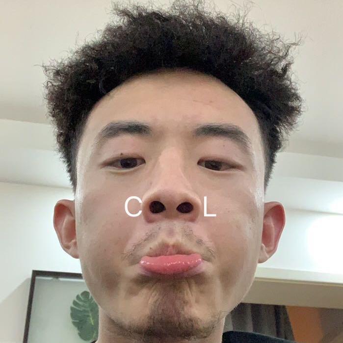 阿伦二麻子