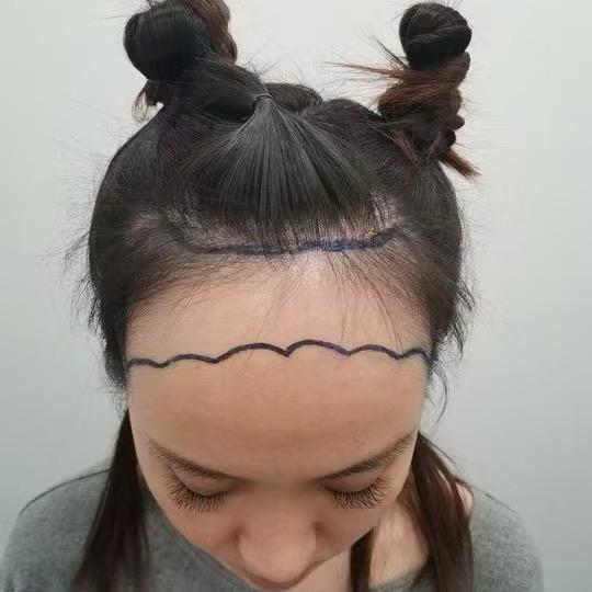 西安毛发美学-李院长