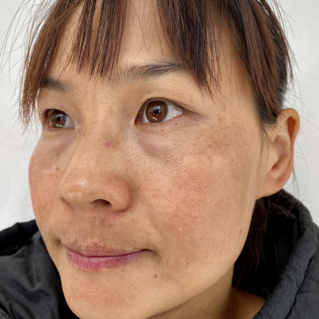 柳枝肌肤管理