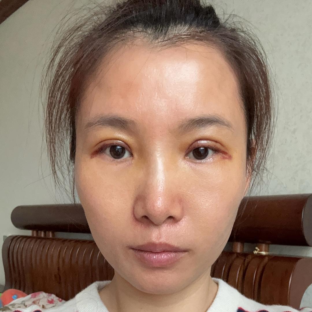 包子加牛奶💋