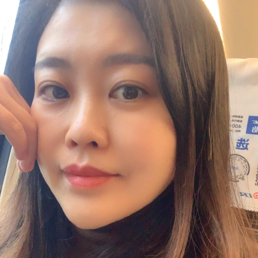 长沙祛斑焕瑟妙妙（4）