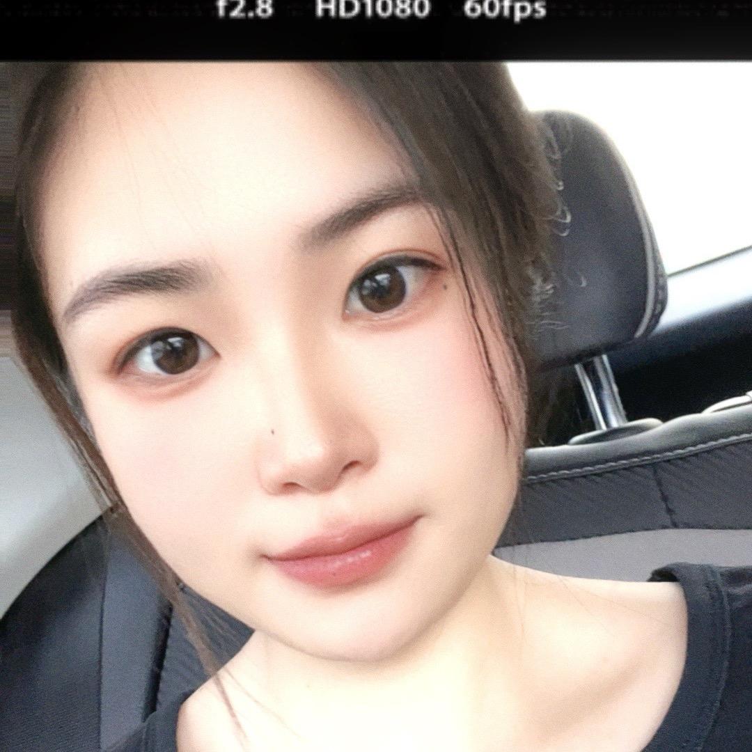 香菜过敏🤷‍♀️