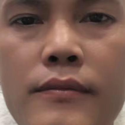 丑小鸭造型