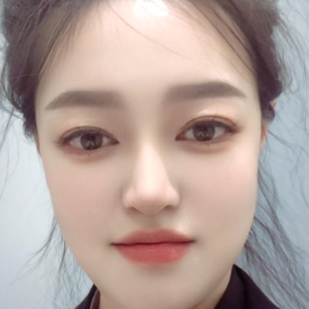 彭碰