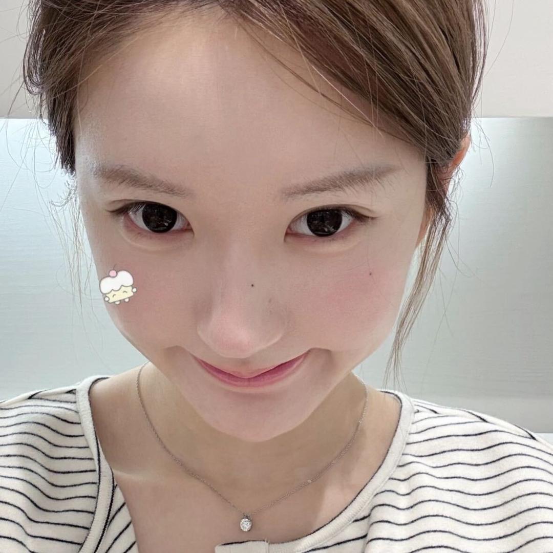 張張