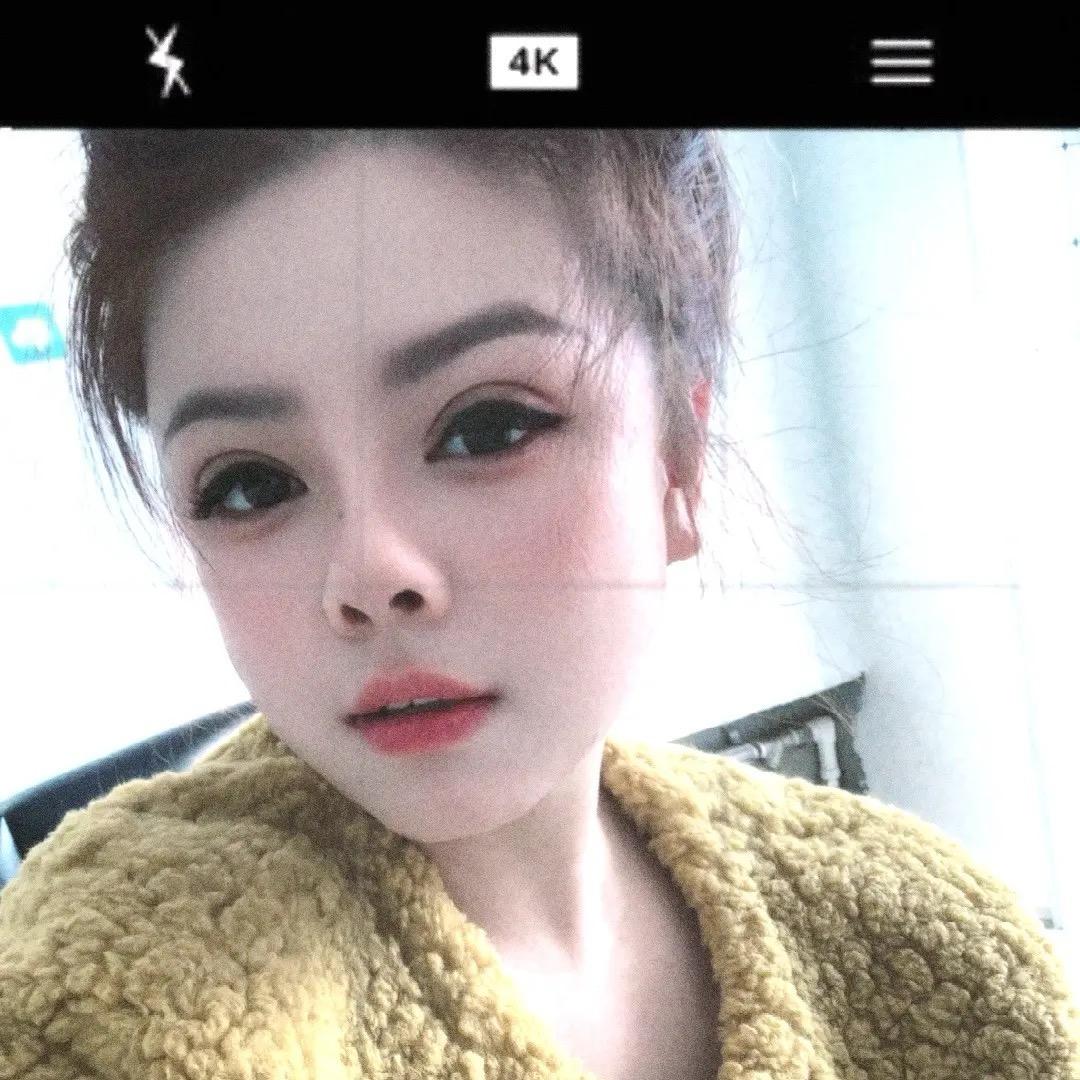 米粒儿